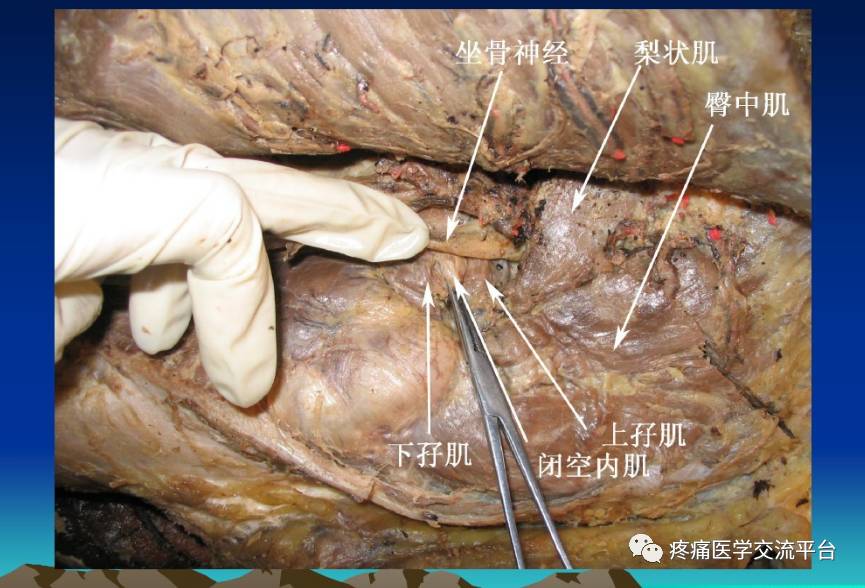 骨科解剖及手术切口入路