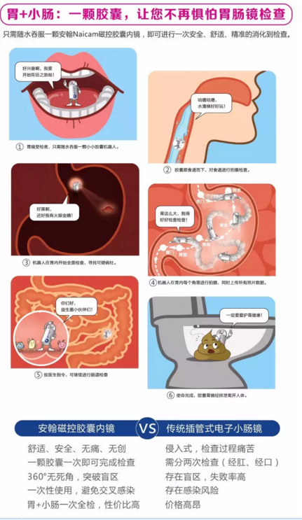 什么是胶囊胃镜检查?绵阳美年大健康告诉你