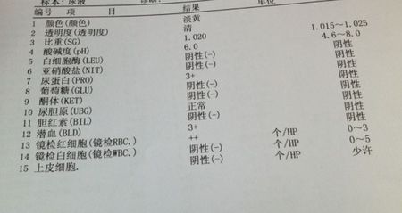 患者因为体检或者别的原因发现尿潜血阳性,或者尿潜血几个"号而忧心