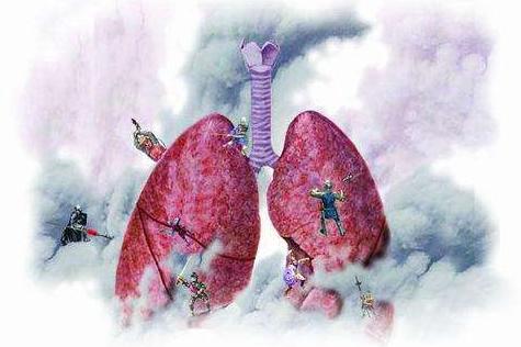 肺癌前兆的五大症状,一定要警惕!