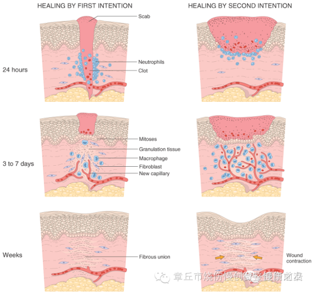 一期愈合和二期愈合图片