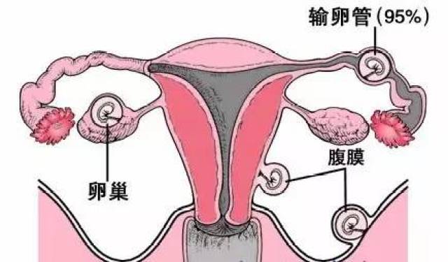 输卵管的位置图图片
