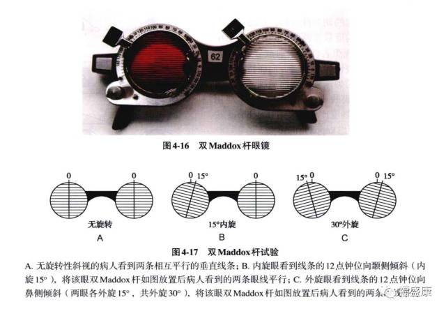 斜视双套环缝线示意图图片