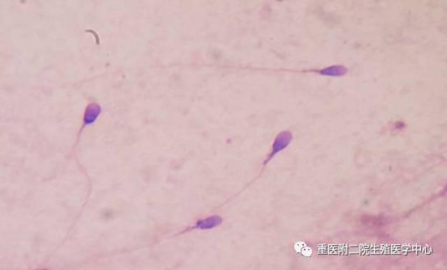 揭开精子的神秘面纱:显微镜下的精子!