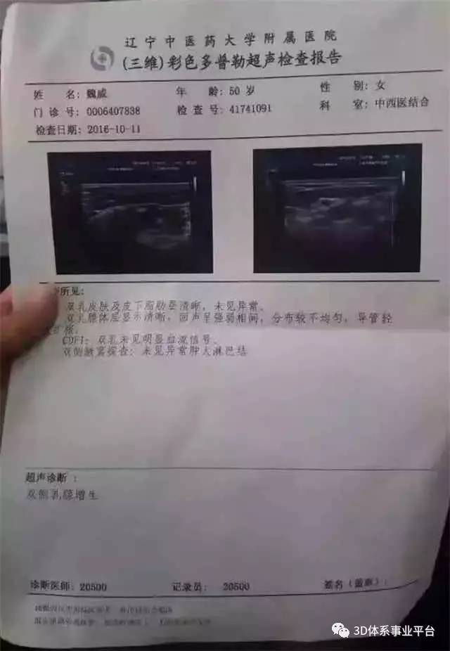 男性乳腺增生病历模板图片