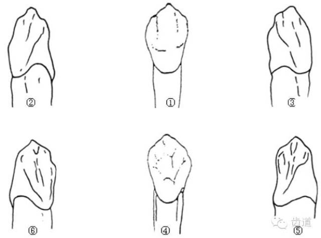 各个牙体雕刻之基本形态要求