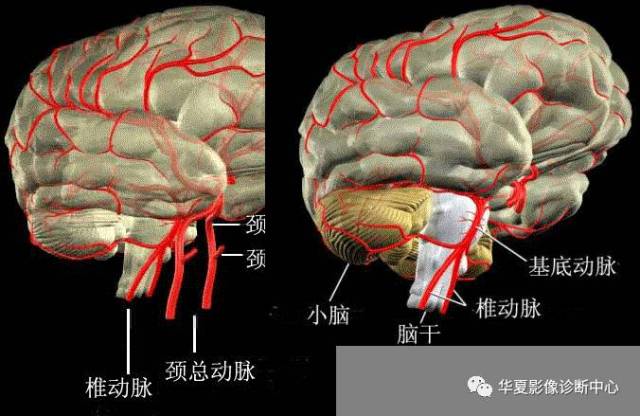 大脑动脉环解剖图图片