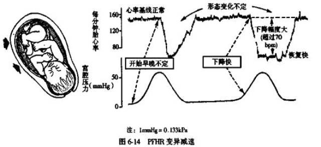 ③晚期減速:宮縮後出現,是胎盤功能不良,胎兒缺氧.