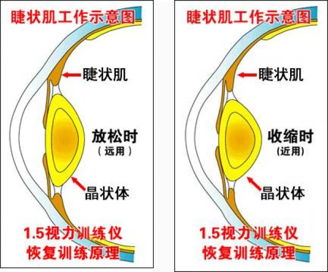 肌肉越用越靈活,為什麼眼睛用多了卻近視了?