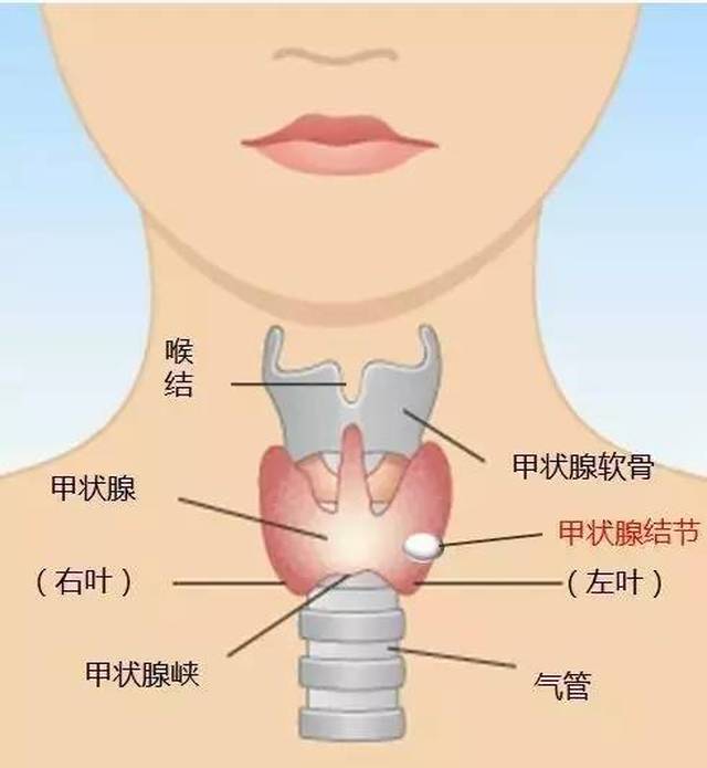 女人甲状腺图片大全图片