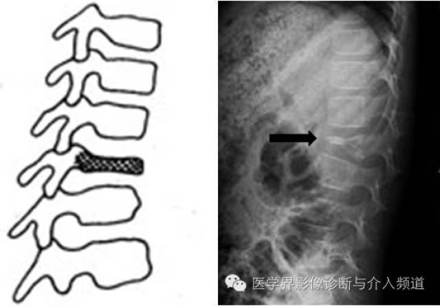 常見/不常見的椎體疾病都在這了!