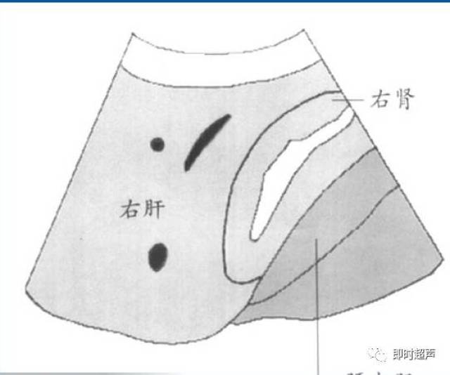 20個肝臟超聲切面圖