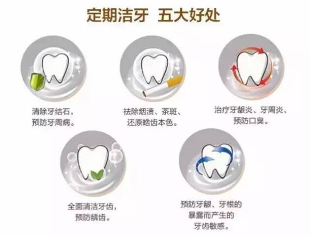 关于洗牙,这十个答案你一定想知道!
