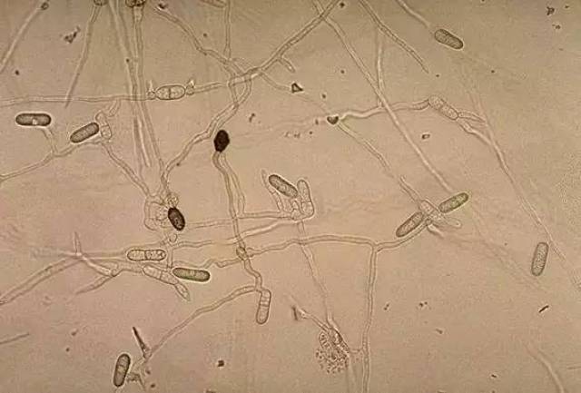 胶孢炭疽菌图片图片