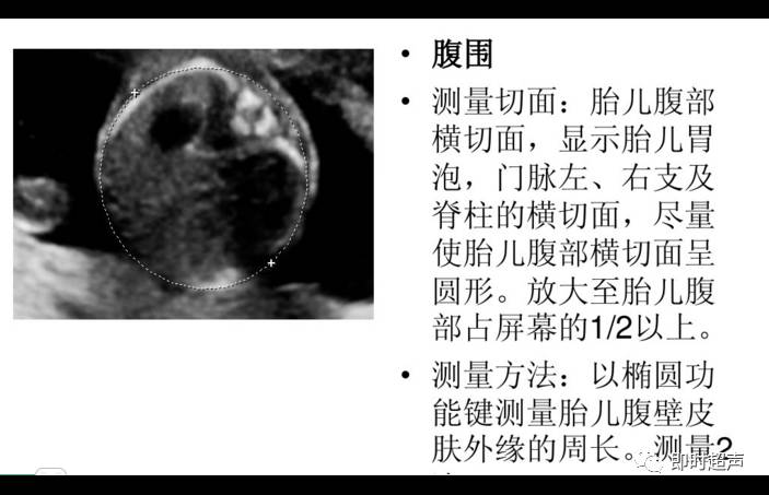 产科超声标准切面25张图