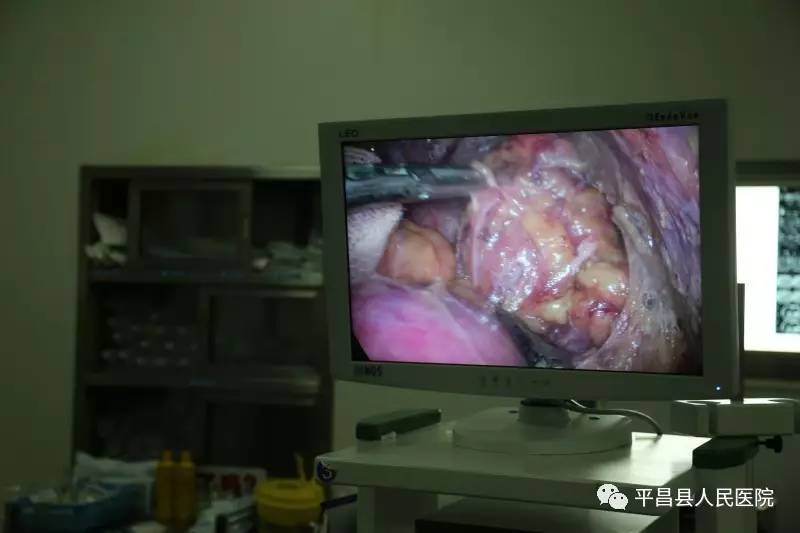 泌尿外科 ‖ 果断出击:后腹腔镜下5厘米肾上腺肿瘤连根挖出