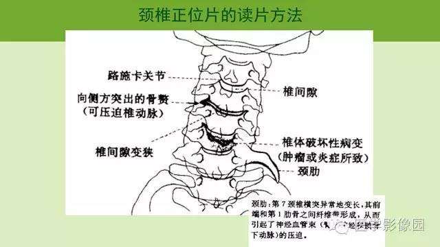 半脫位的臨床診斷;3.脊椎骨關節解剖特點;4.脊椎臨床實用生物力學;5.