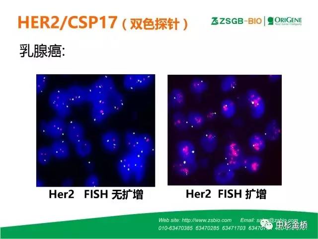 【技语】病理常用fish探针种类与判读技巧(简易版)