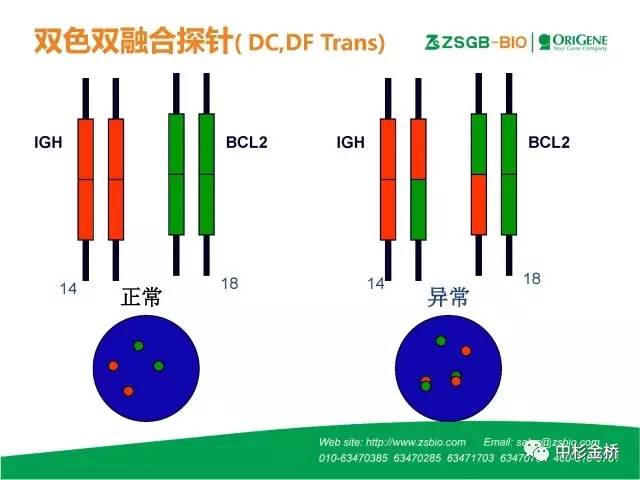 【技语】病理常用fish探针种类与判读技巧(简易版)