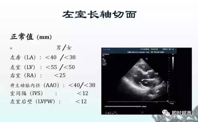 肺动脉高压分级※ 慢性肺源性心脏病※超声心动图评估瓣膜反流