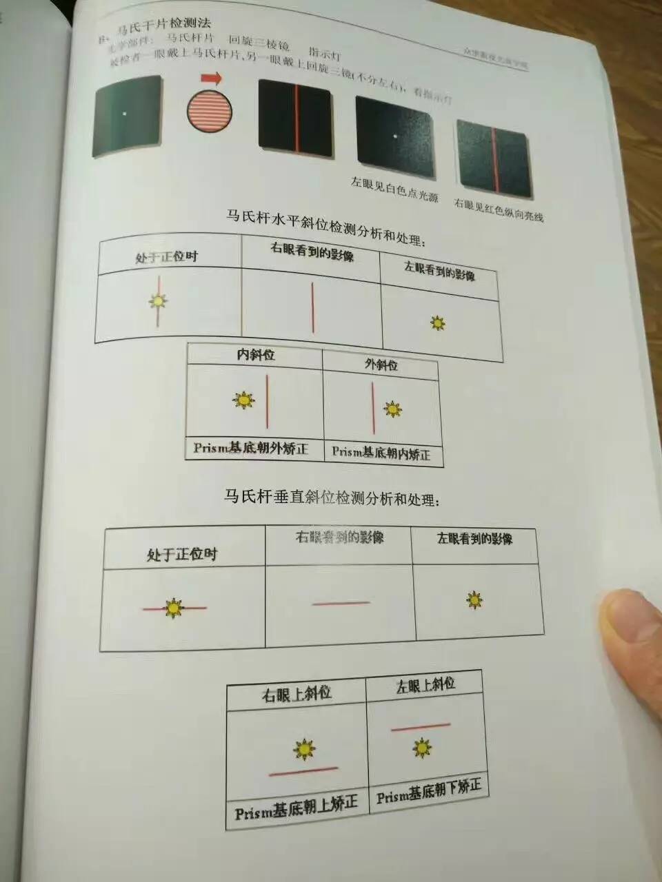 視功能檢查雙眼視異常分析視覺訓練