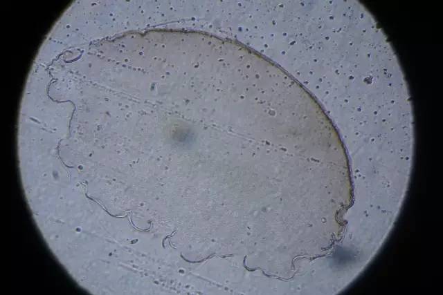 蛙卵单细胞切片图片