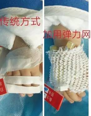 厉害了!重庆一医院4科室护理人员创作出18项小发明