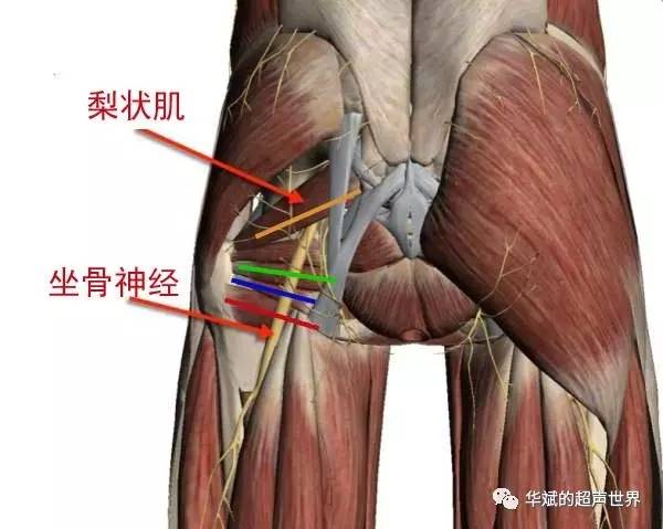 神經超聲解剖臀部坐骨神經