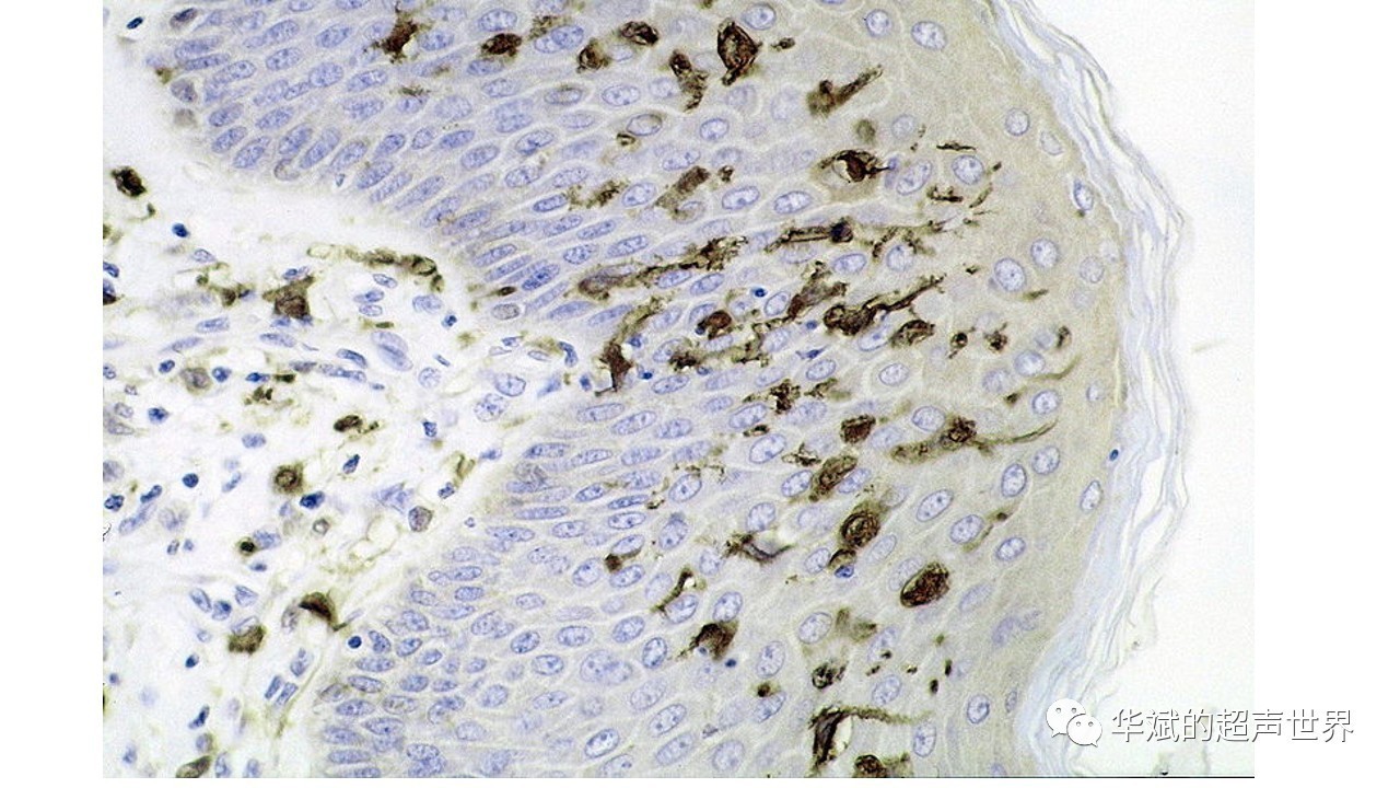 图2 皮肤表皮内的树突状细胞(维基百科英文网站)
