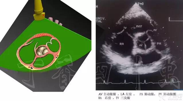 心臟解剖筆記圖解超聲切面