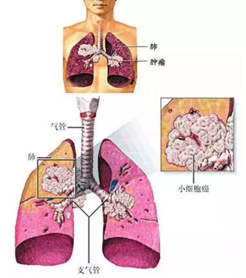 肺臟不像別的器官,它