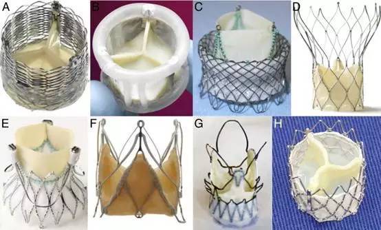 valve prothesis)是可植入心脏内代替心脏瓣膜(主动脉瓣,三尖瓣