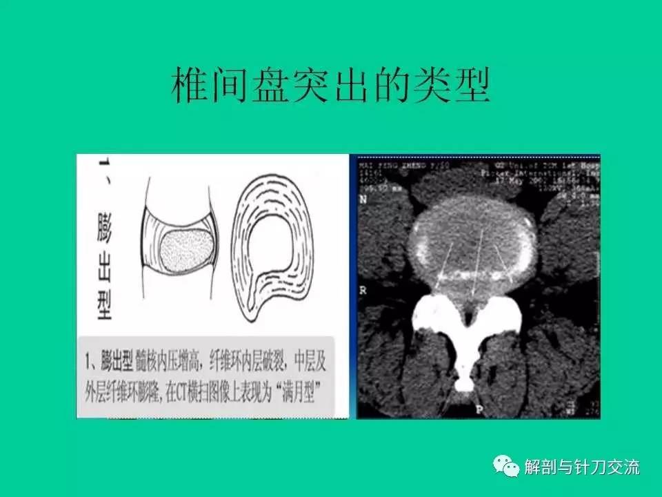 腰椎基本結構視頻