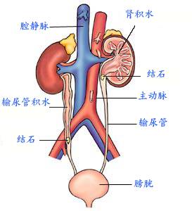 人体下水道堵了别怕下水道工人有钻孔取井的本事