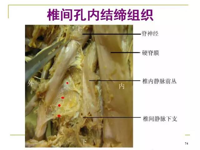 腰椎間孔的解剖與臨床