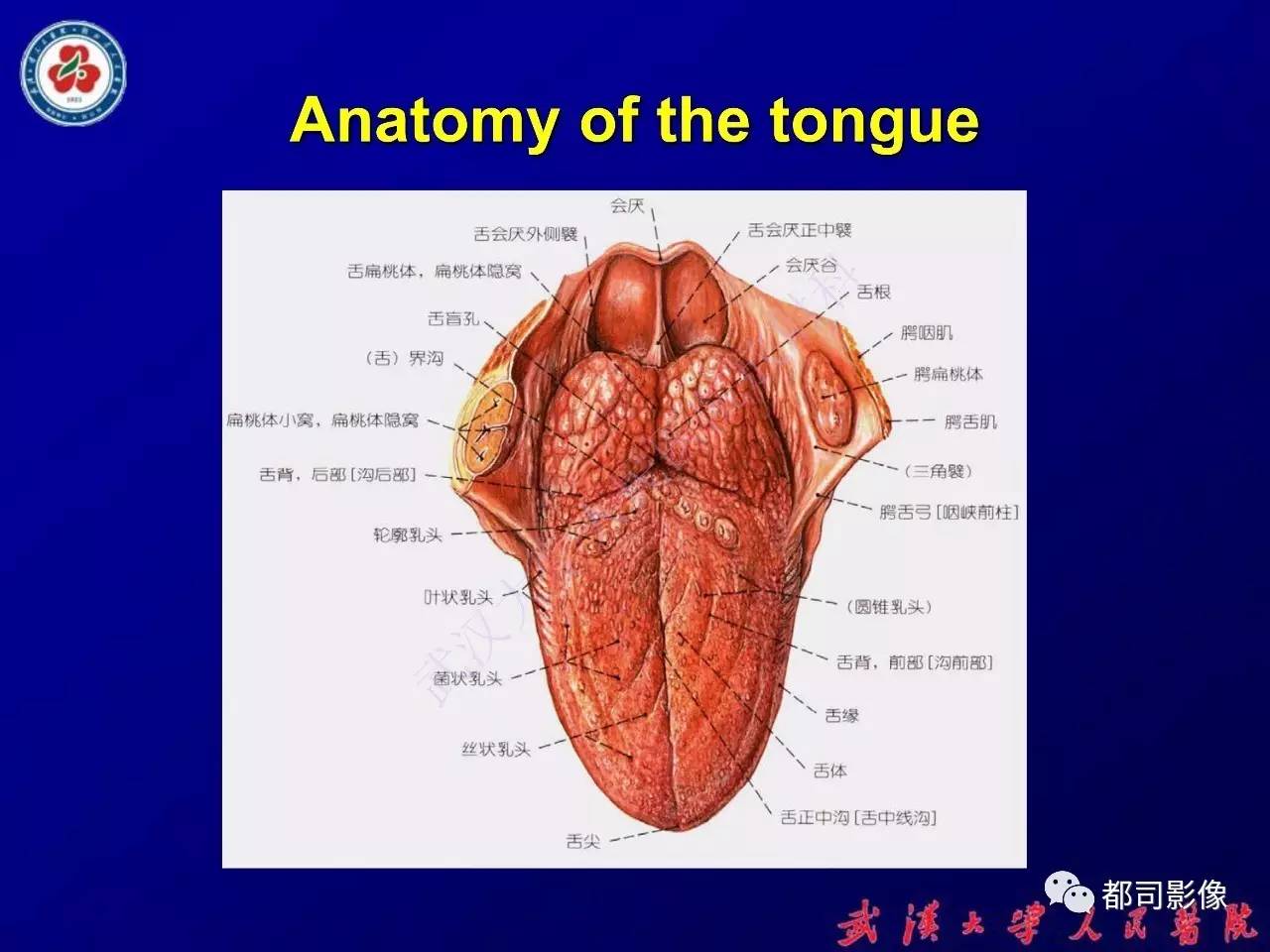 舌部常见病变及鉴别诊断