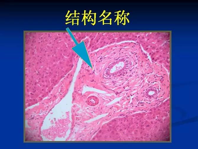 肝细胞索和肝窦图片图片