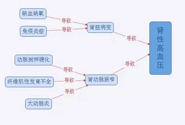 那肾性高血压怎么治疗呢?