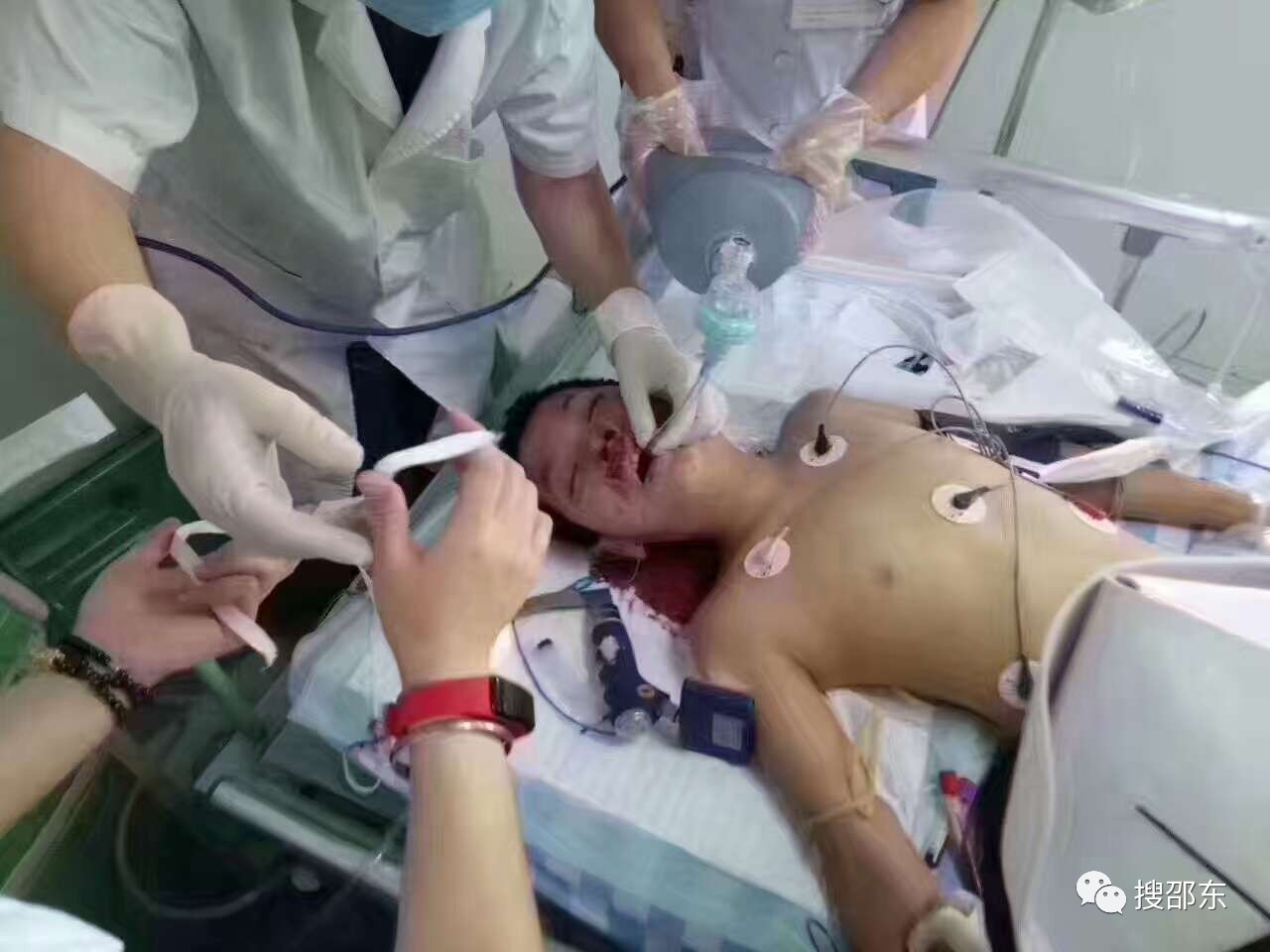 小男孩正在医院进行抢救小孩妈妈已经赶到医院最后希望这个小男孩早点
