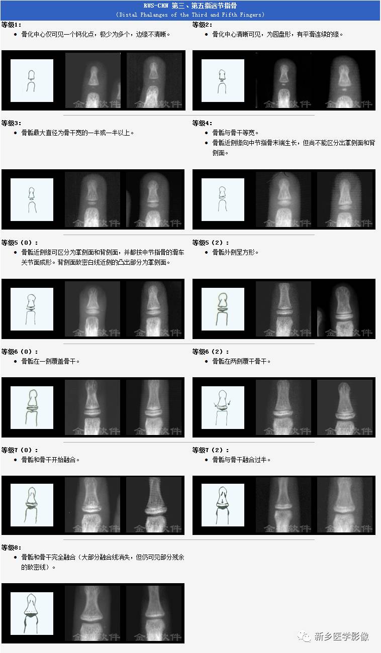 9岁女孩骨龄片对照表图片