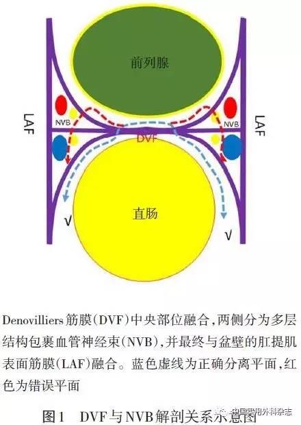 dvf是位於腹膜反折與會陰體之間的緻密纖維平滑肌組織,最早於1837年為