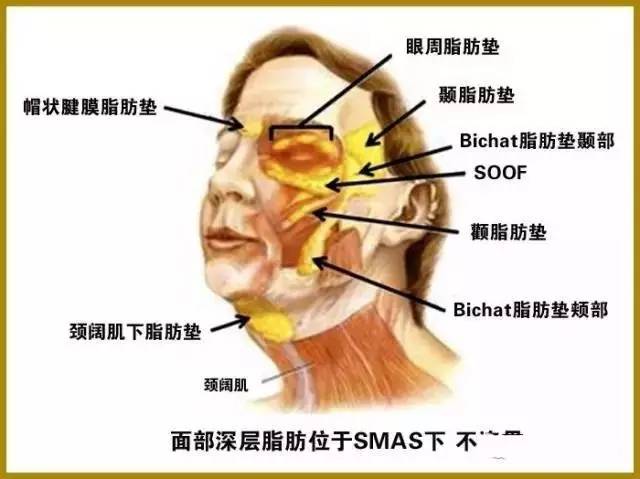 所以抗衰老手术会用脂肪填补太阳穴所以,上面部的脂肪垫和smas筋膜的