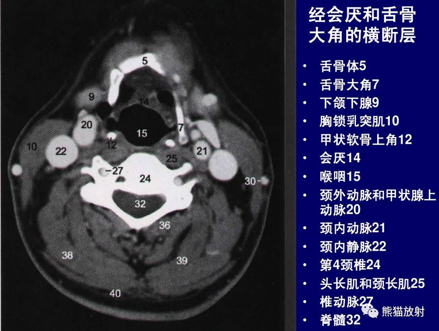 颈部软组织CT解剖图片