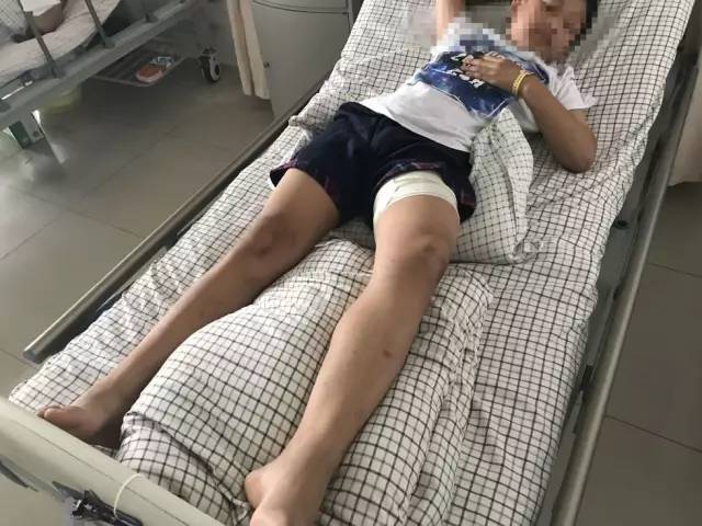 合肥12岁男孩骑小黄车车把手扎进大腿根部,这些隐患家长一定要看!