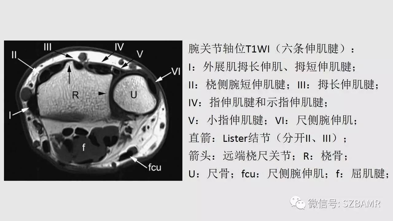 腕手磁共振成像正常解剖与变异