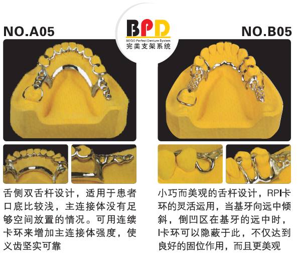 口腔可摘局部義齒支架設計大全