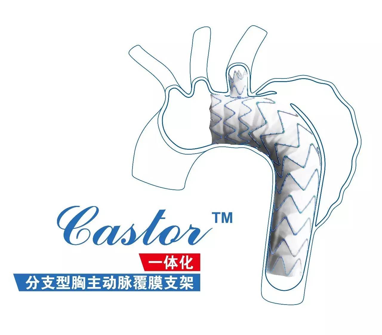 【喜讯】castor分支型主动脉覆膜支架及输送系统获得cfda注册证