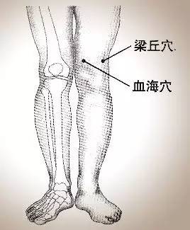 針灸治療膝關節腫痛,膝關節積液