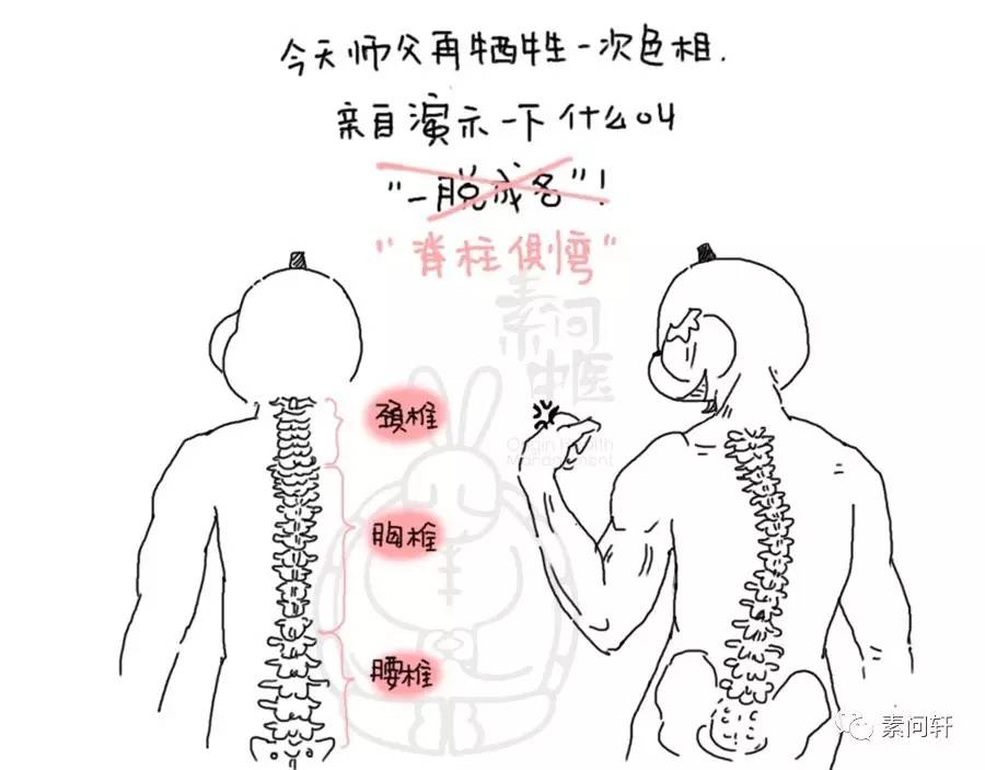 其是指脊柱的一個或數個節段在冠狀面上偏離中線向側方彎曲,形成帶有