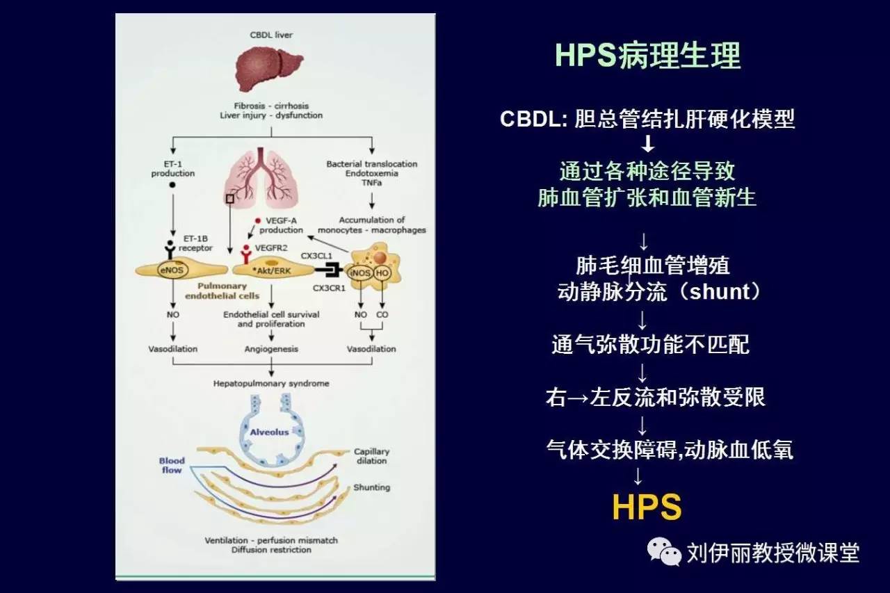 欢迎大家关注刘伊丽教授微课堂返回搜狐,查看更多